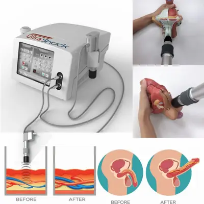   2 in One Ultrashock pneumatic shockwave therapy device for pain relief  ED function fat reduction