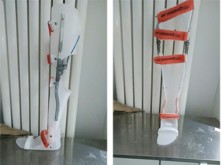 Knee Joint Prosthesis