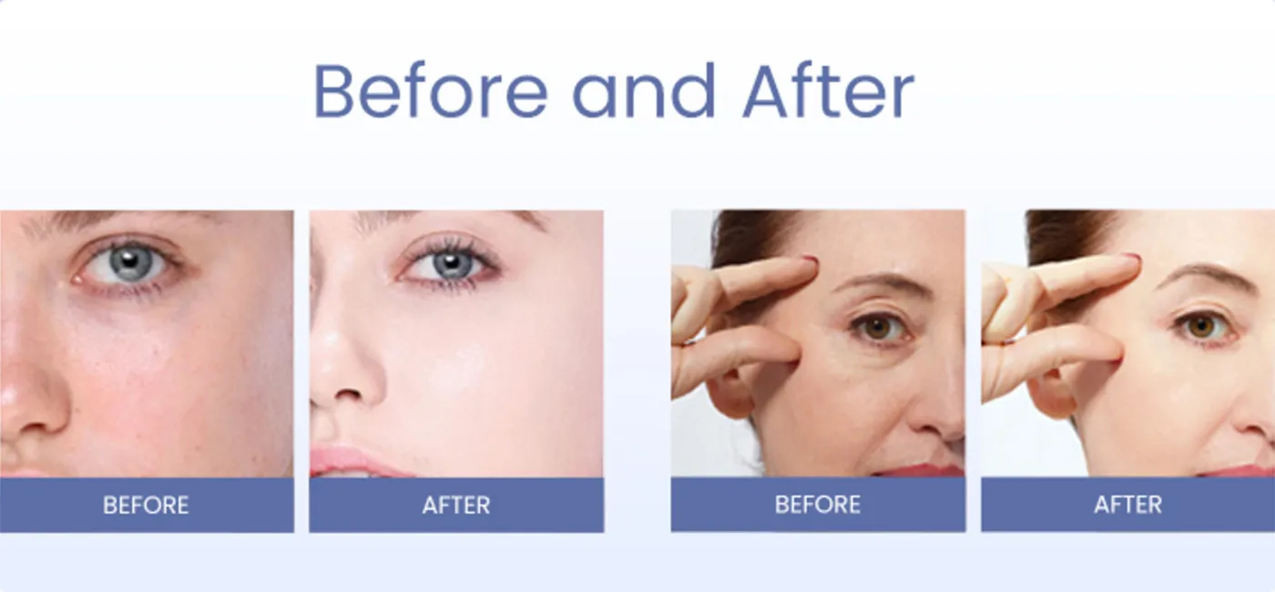 Skin Rejuvenation – PDRN & Exosome Therapy Skin Rejuvenation – PDRN & Exosome Therapy