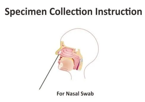 Accu-Tell COVID-19 Antigen Nasal Swab Whole Set.JPG