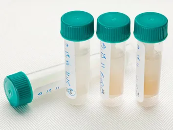 virus sample collection tube