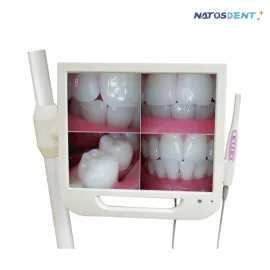 Sistema de cámara dental con monitor 17 pulgadas NTS-HDA