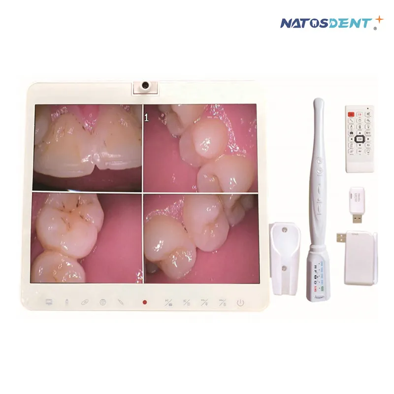 Intraoral Camera