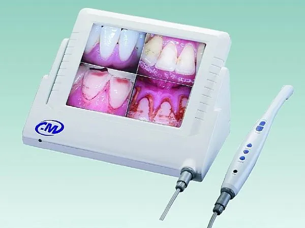 intraoral camera