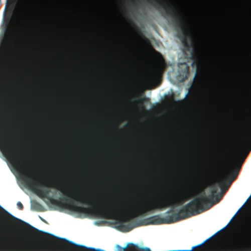 One of the key advantages of colposcopy equipment is its ability to perform biopsies during the examination. This allows healthcare providers to take samples of suspicious tissue for further analysis, helping to guide treatment decisions. Additionally, colposcopy equipment is minimally invasive and does not require anesthesia, making it a convenient and well-tolerated procedure for patients. The procedure is usually quick, with results available shortly after the examination.