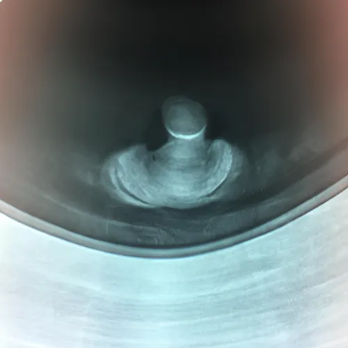 Another important application of colposcopy equipment is in follow-up care after abnormal Pap smears. By providing a detailed view of the cervix and surrounding tissues, colposcopy equipment can help monitor the progression of abnormal cells over time. This allows healthcare providers to closely monitor changes in the cervix and make informed decisions about the need for further interventions. With its ability to detect subtle changes in tissue, colposcopy equipment plays a critical role in the 