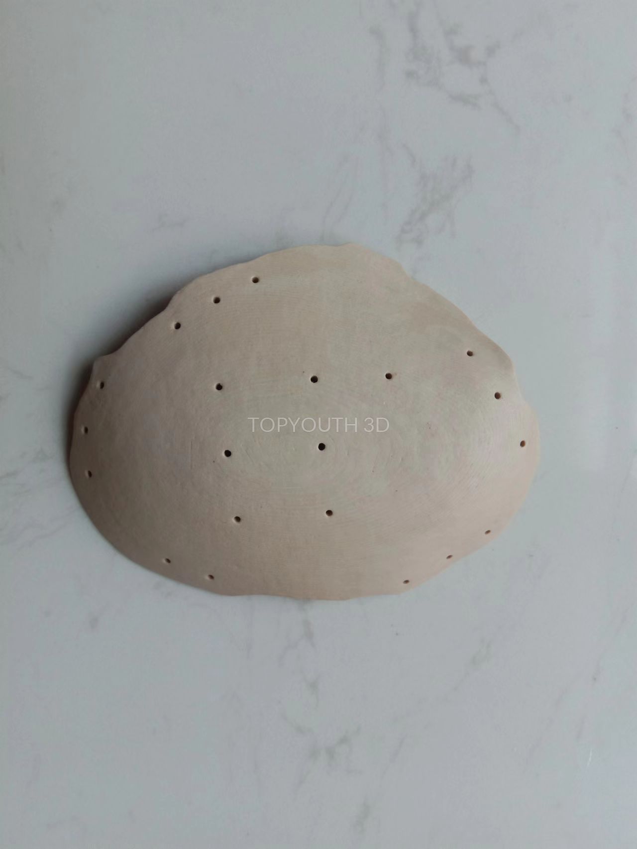 Cranioplasty Example-52: 3D Printed PEEK Cranial Implant