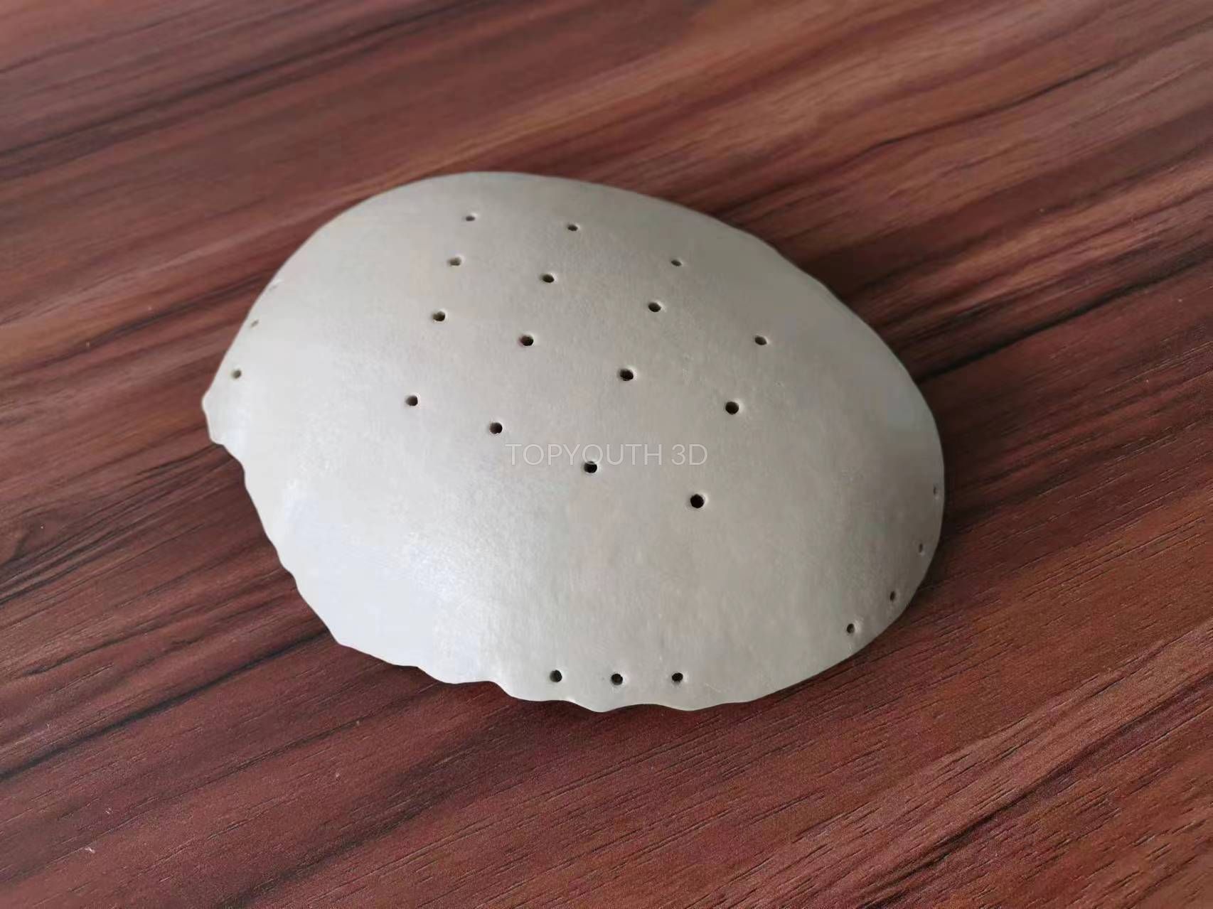 Cranial Repair: PEEK Cranial Implant Customization - Example 55