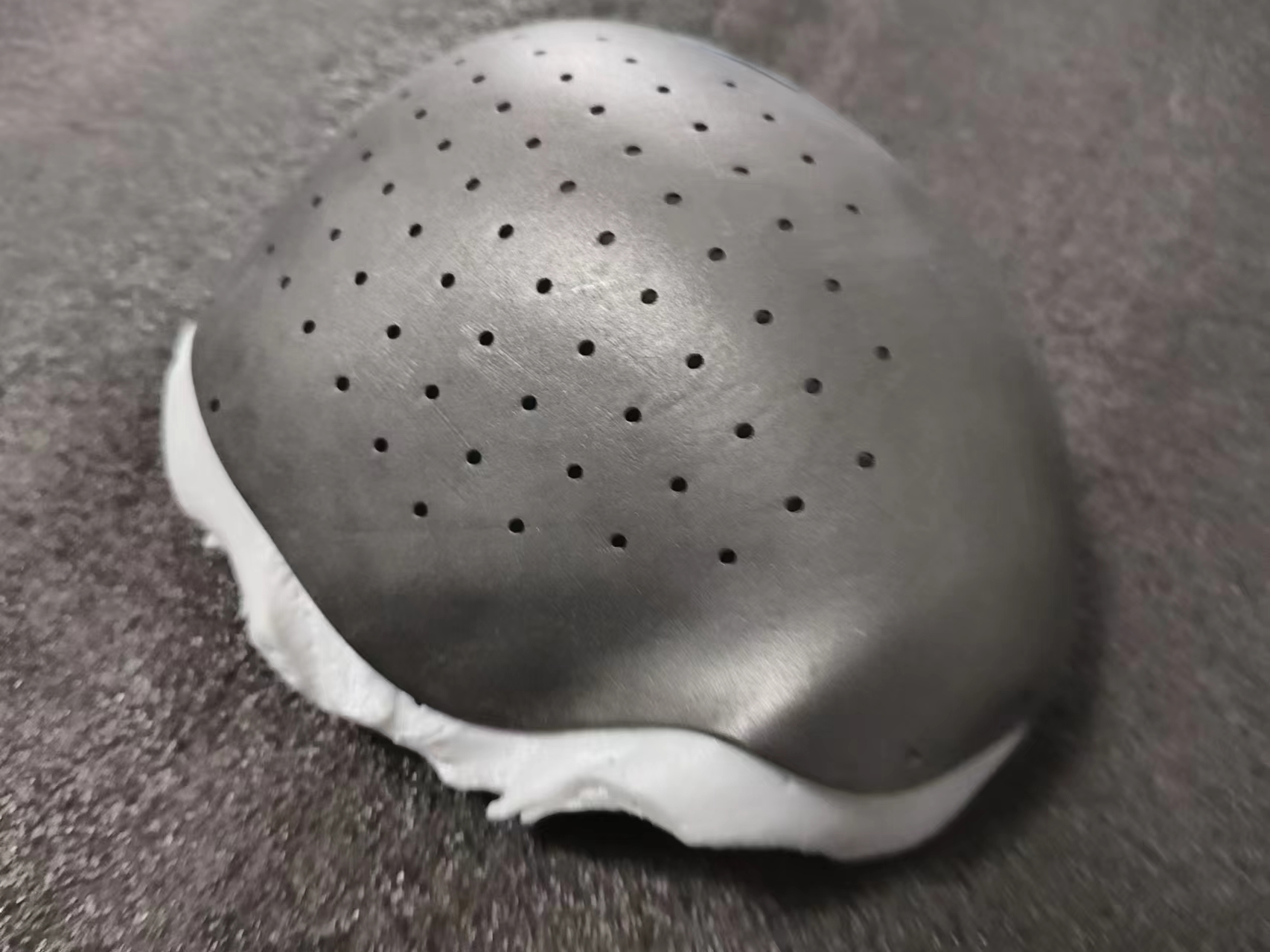 3D Printed Prostheses: Selection of Cranial Repair Materials