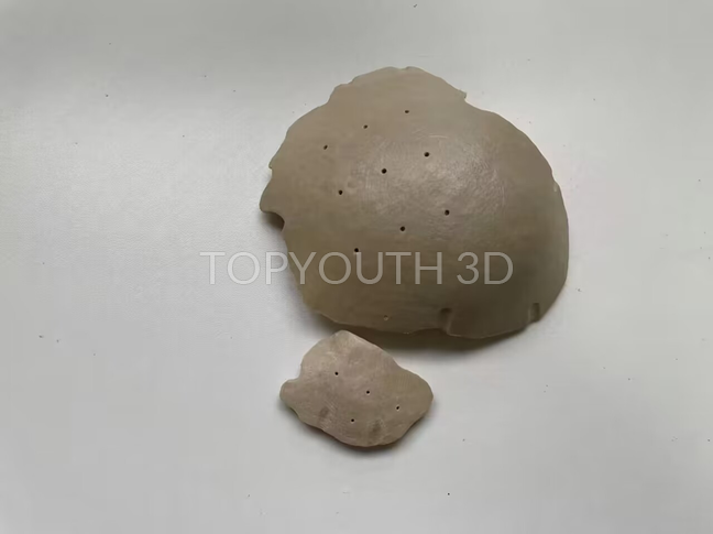 3D 打印 PEEK 颅骨板