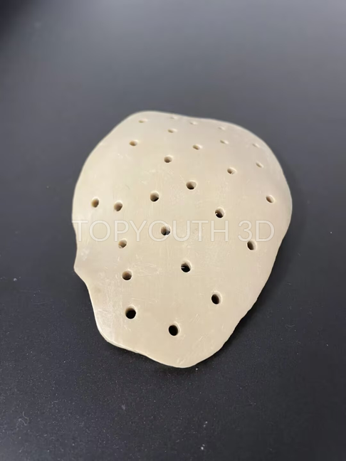 3d printing peek skull plate