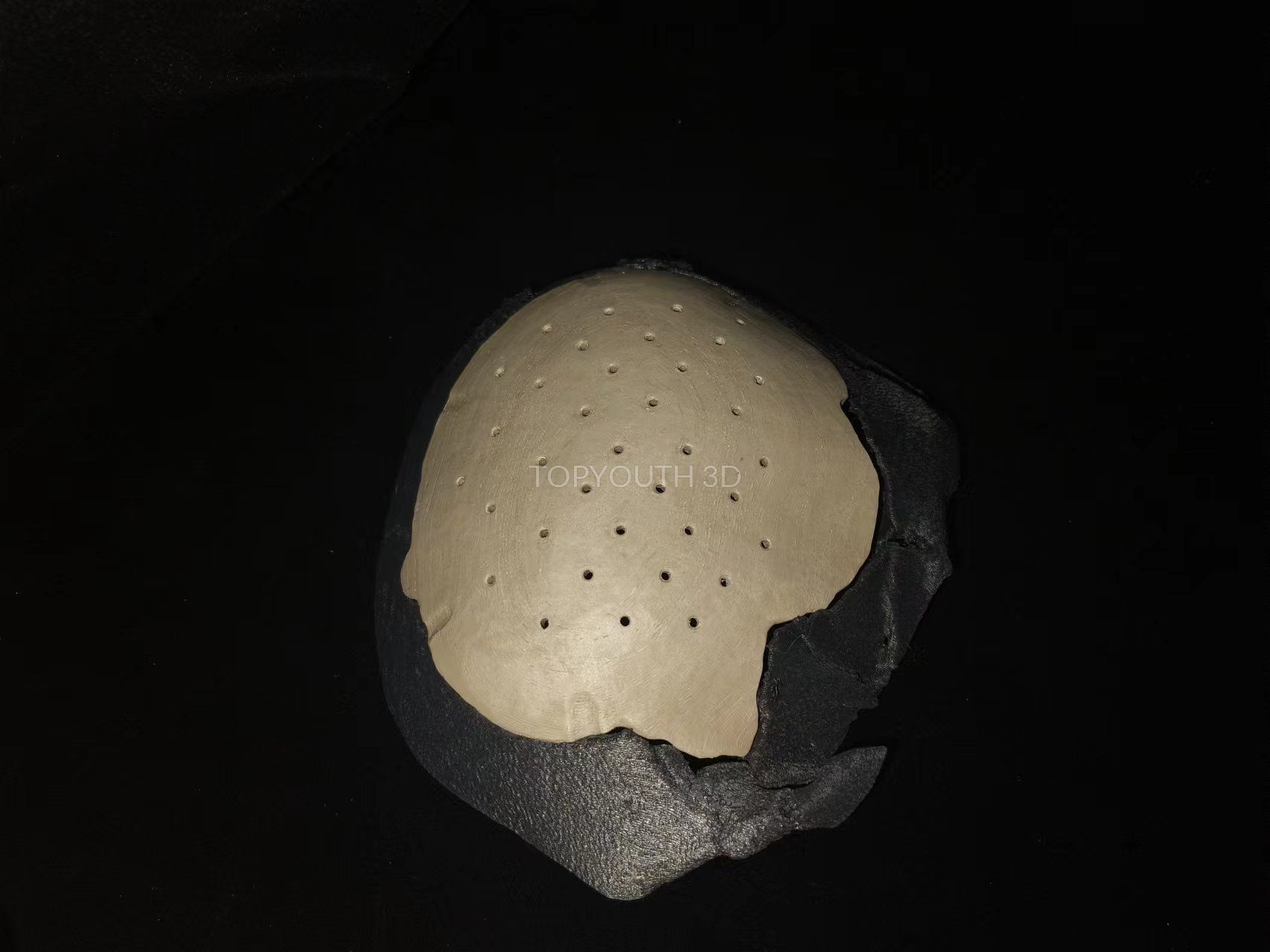 3D Printed PEEK Skull Plate - Example 46