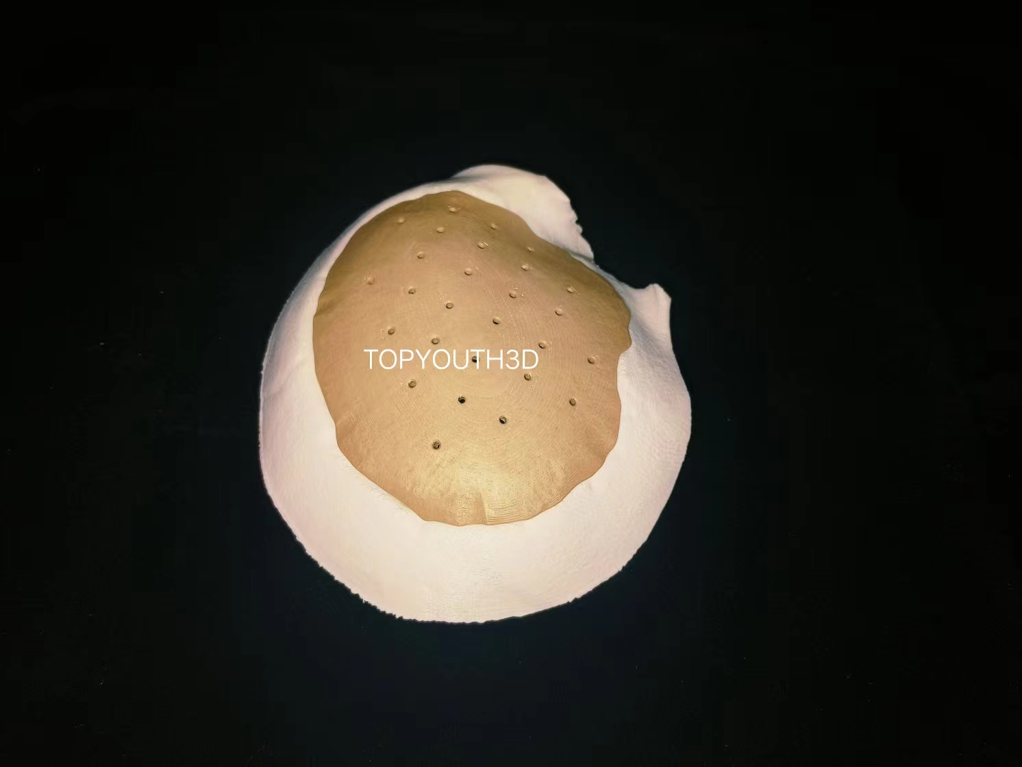 3D printing applications in health care: PEEK cranial plates