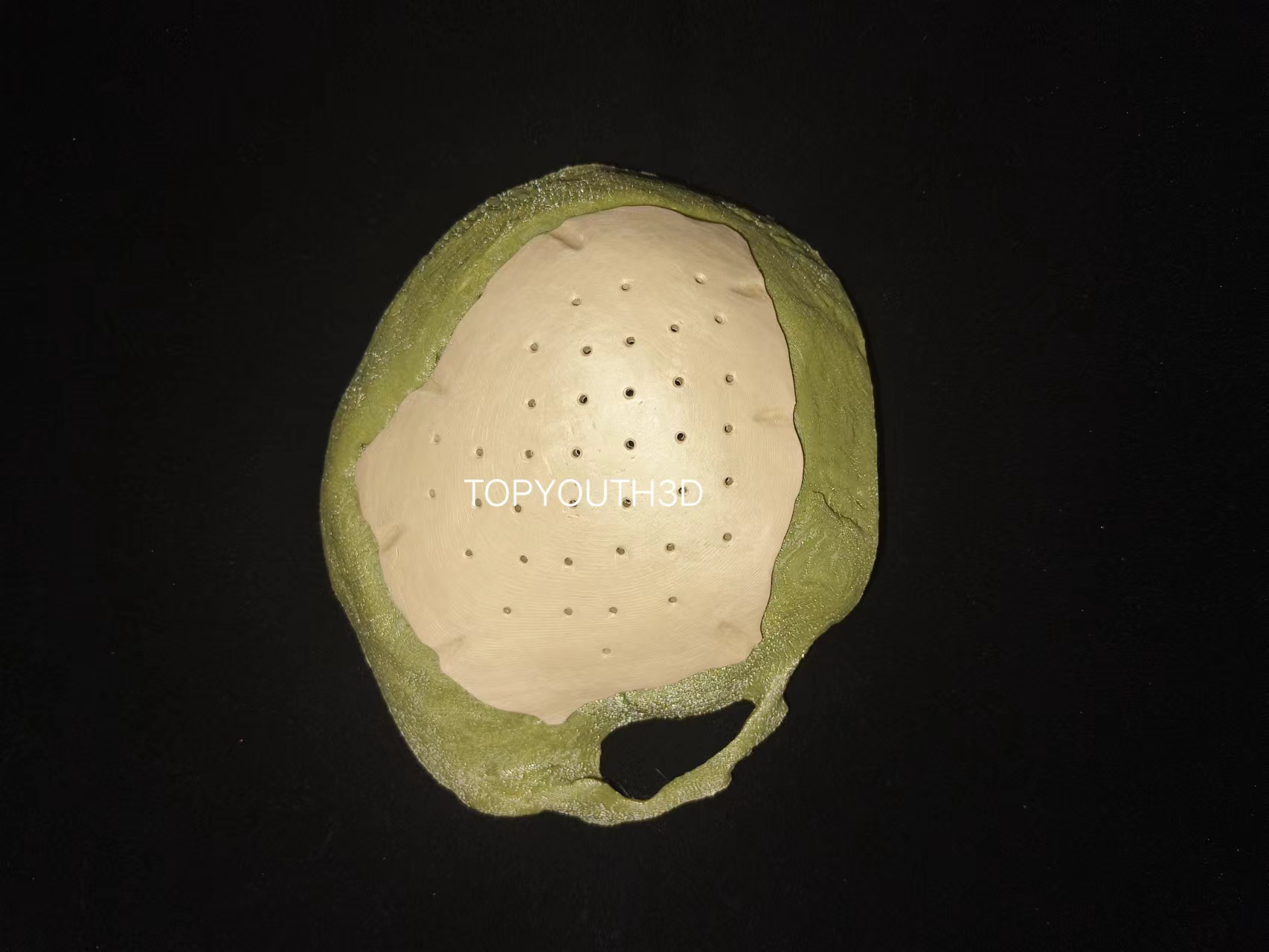 3d 打印医疗器械：PEEK颅骨修复板