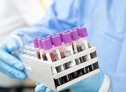 WHO Urges Rapid Access to Mpox Diagnostic Tests, Invites Manufacturers to Emergency Review