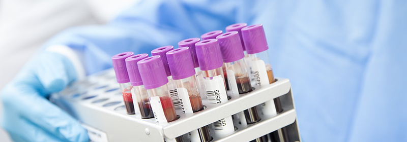 WHO Urges Rapid Access to Mpox Diagnostic Tests, Invites Manufacturers to Emergency Review