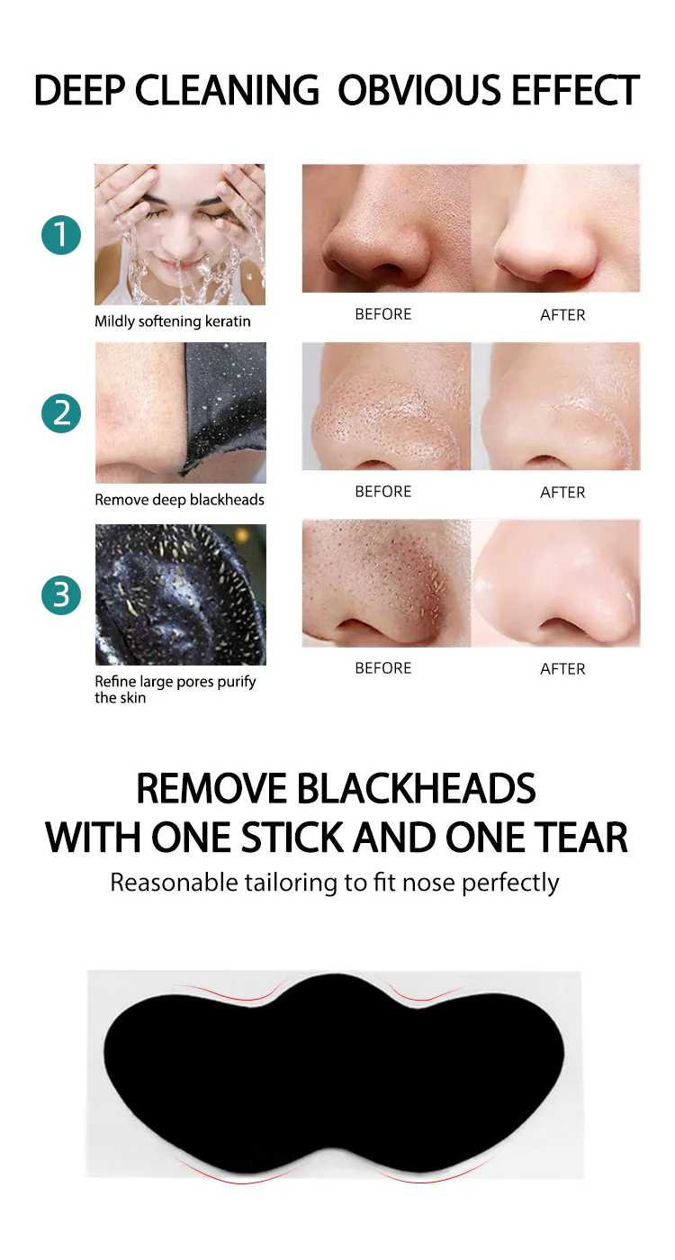 Black Head Remove Nose Mask