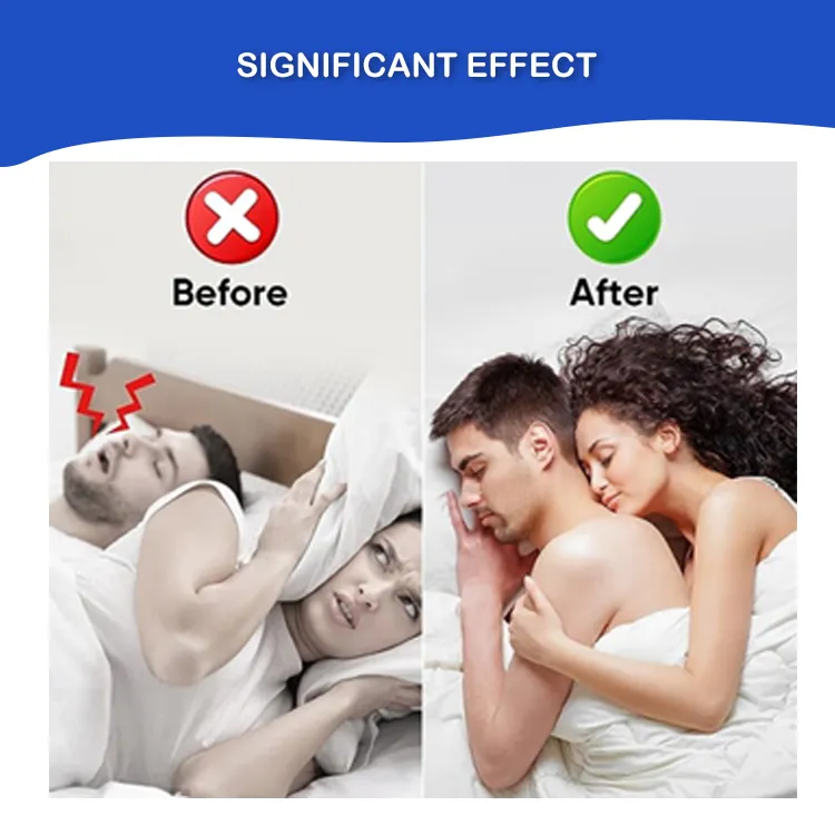 Anti Snore Sleep Customized Nasal Strips