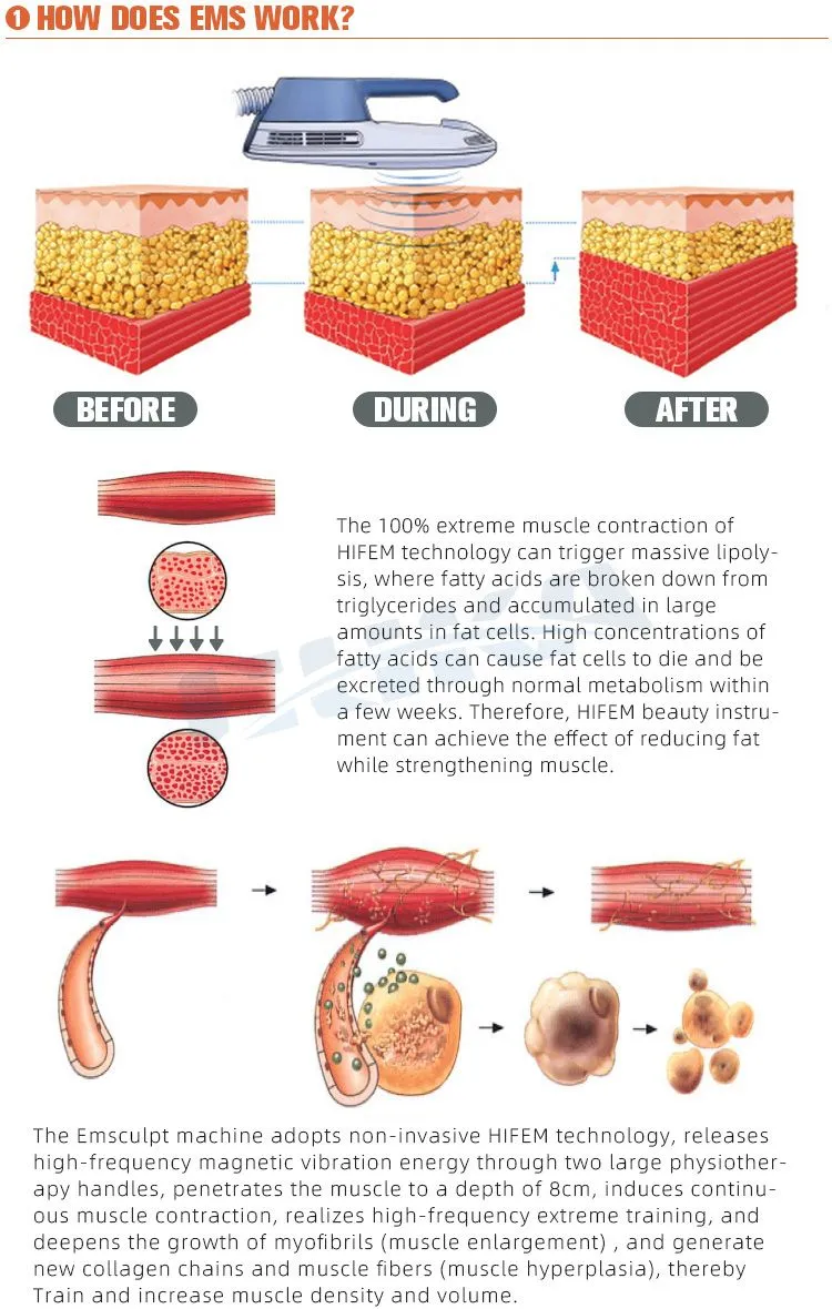 Four Handles Emsculpt Machine For Muscle Stimulator