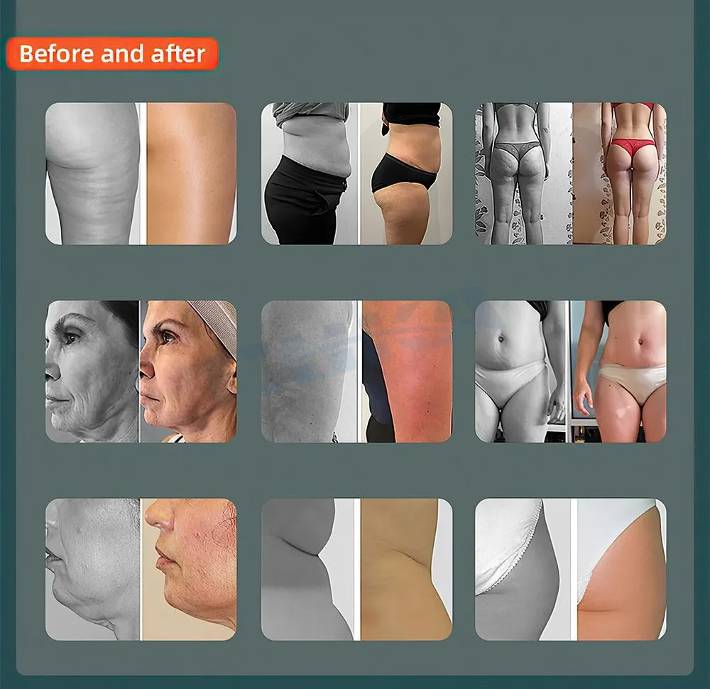 2 in 1 Roller Machine