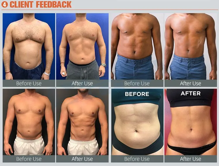 Four Handles Emsculpt Machine For Muscle Stimulator