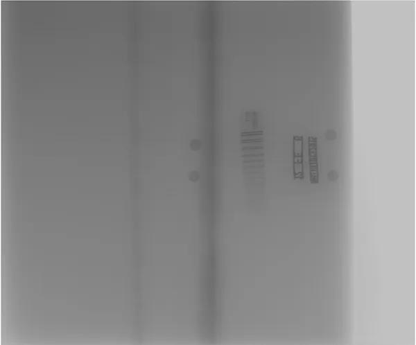 Portable Digital Radiography (DR) Inspection System