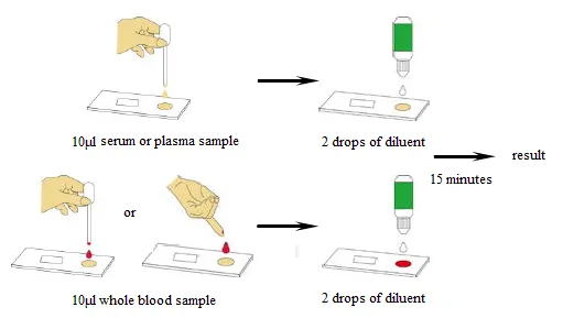 Monkeypox Virus Antigen Detection Kit (Colloidal Gold Method)