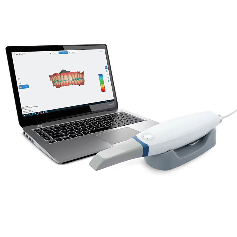 Runyes 3d dental scanner,dental scanner, Intraoral Scanner