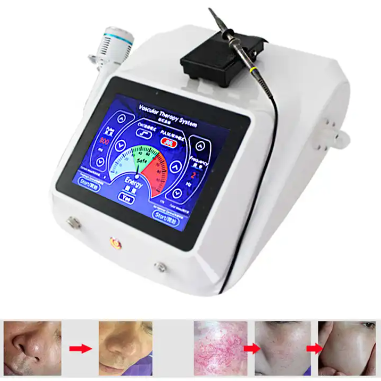 RF Vascular Removal Machine