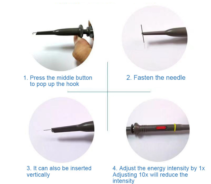 RF Vascular Removal Machine