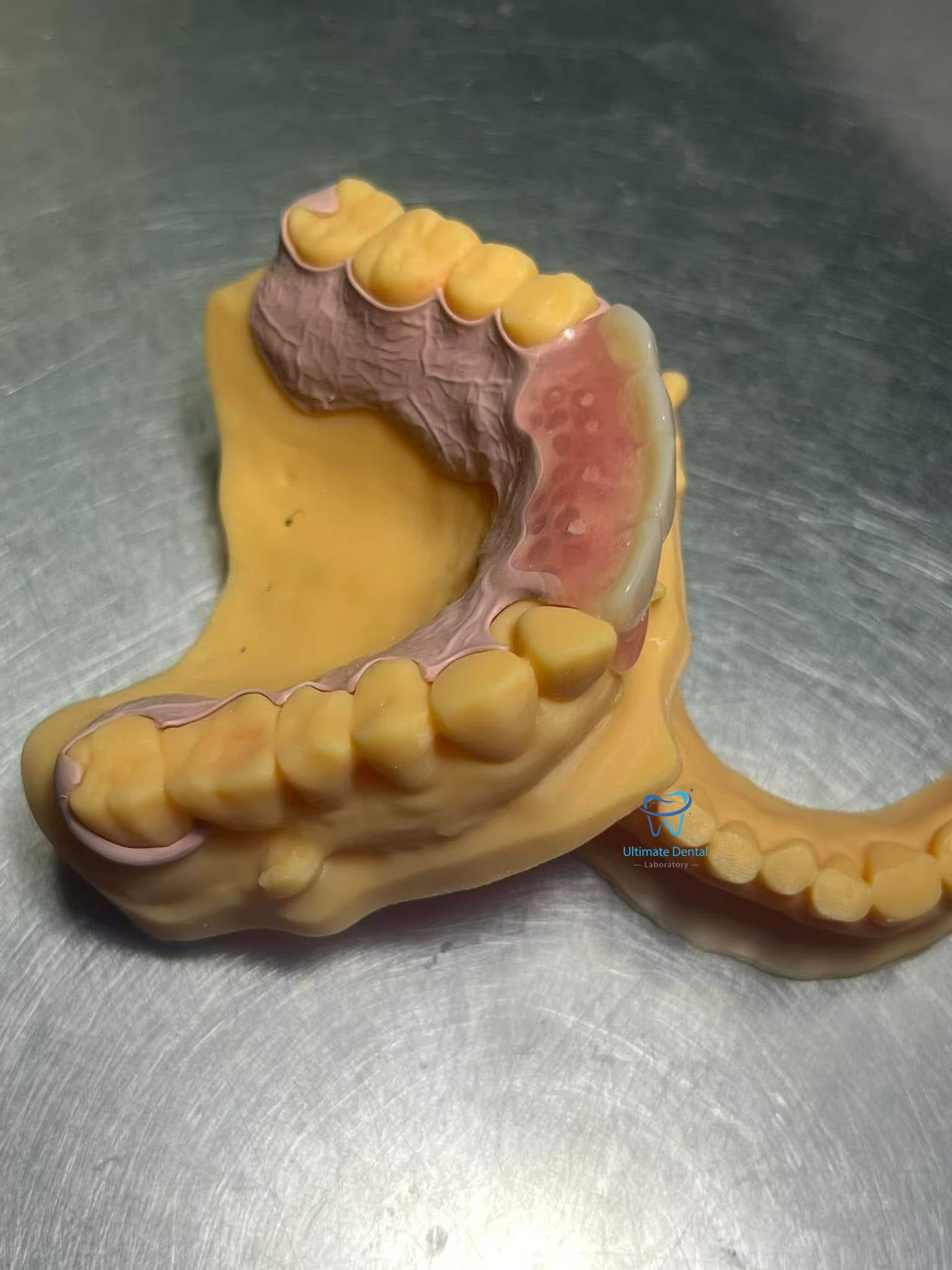 Cosmetic Dental Braces