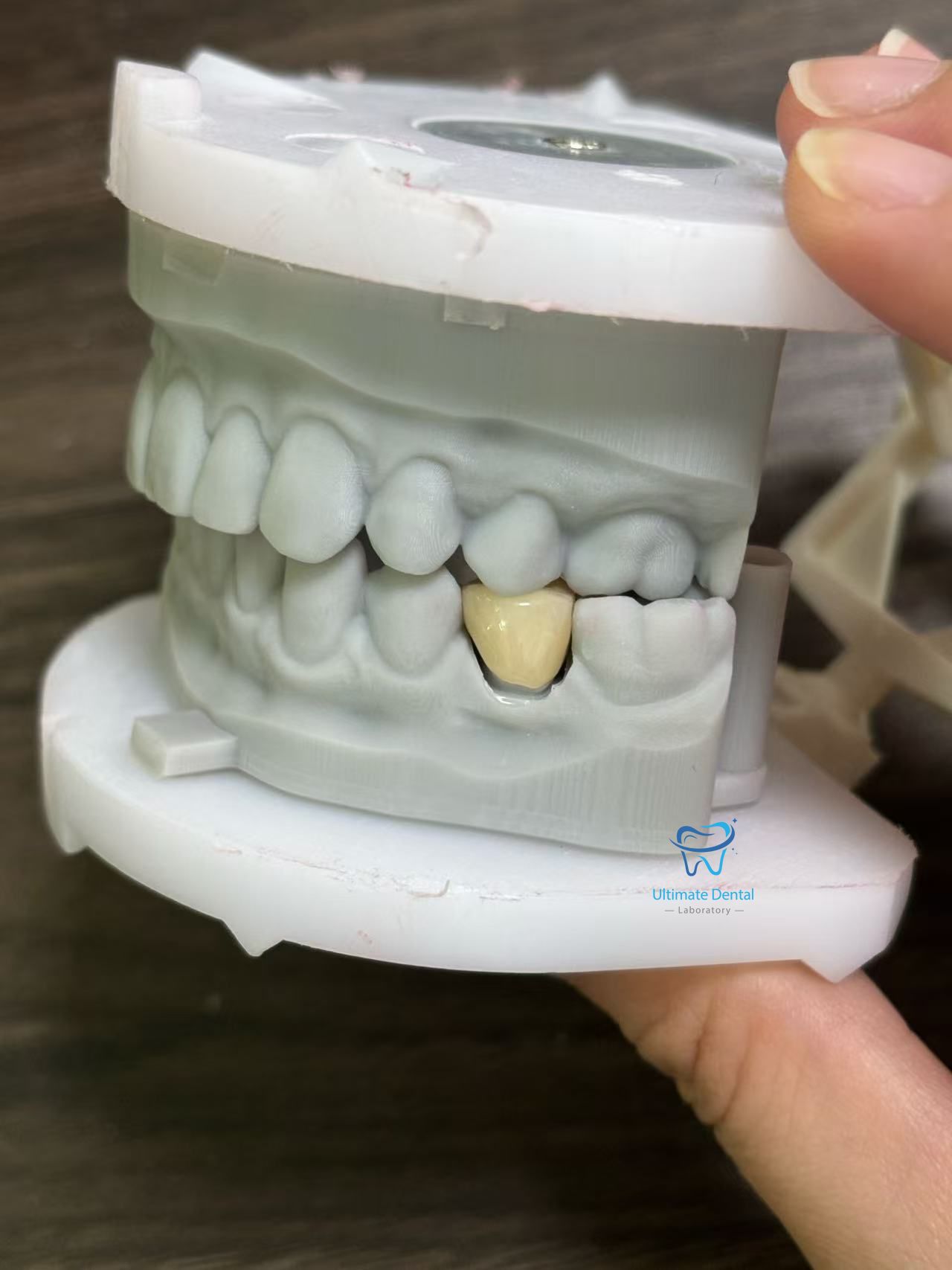 Implant Bridge / Ma LongBridge