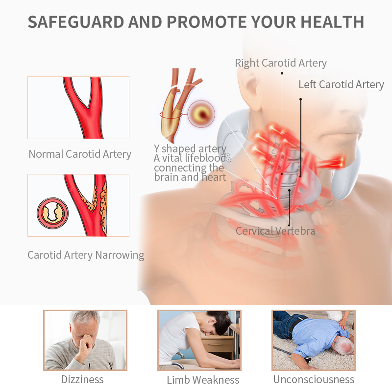 Health Education | The Lifeline of the Human Body: Carotid Arteries