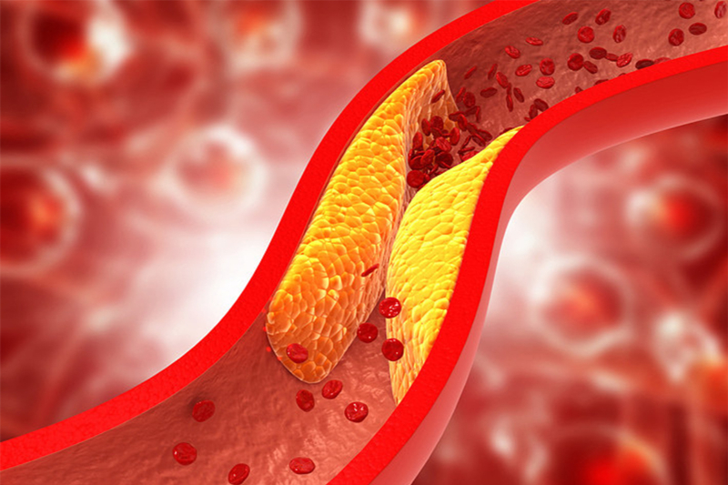 Health Education | The Lifeline of the Human Body: Carotid Arteries