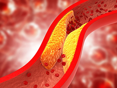 Carotid Arteries - The Lifeline of the Human Body