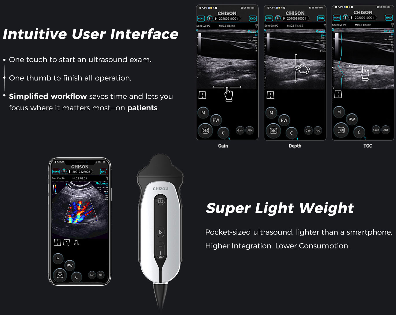 CHISON SonoEye handheld ultrasound device
