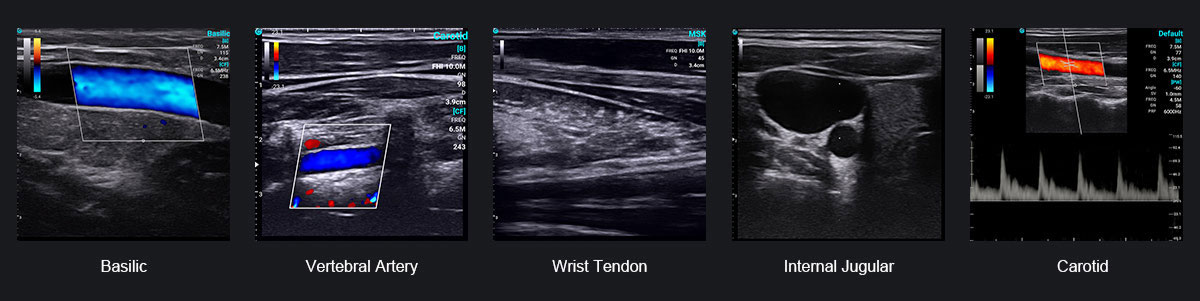 Discover SonoEye: Advanced Handheld Ultrasound for POCUS at FIME 2024