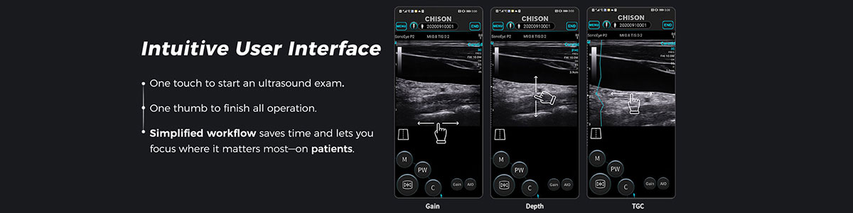 Discover SonoEye: Advanced Handheld Ultrasound for POCUS at FIME 2024