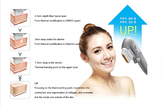 Portable 7D HIFU Face Lifting Wrinkles Removal Machine