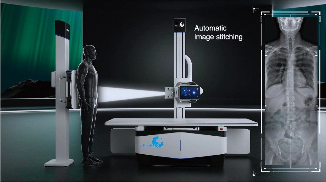 Digital X-ray Radiography System