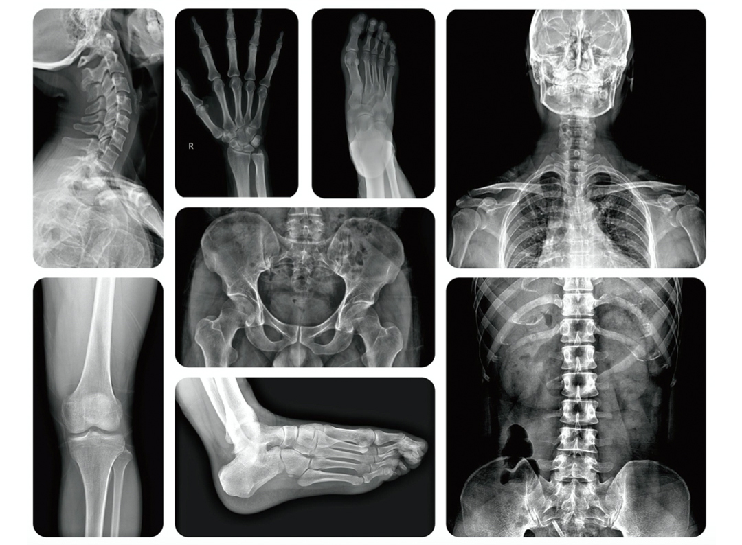 Digital X-ray Radiography System