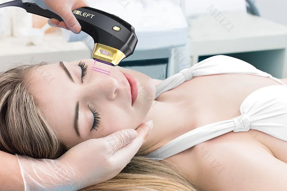 Highlight Features of Meizi's HIFU Machine Highlight Features of Meizi's HIFU Machine