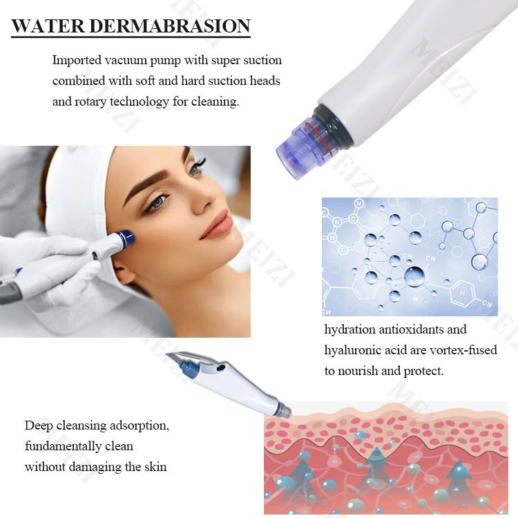 What is Hydrodermabrasion? Everything You Need to Know