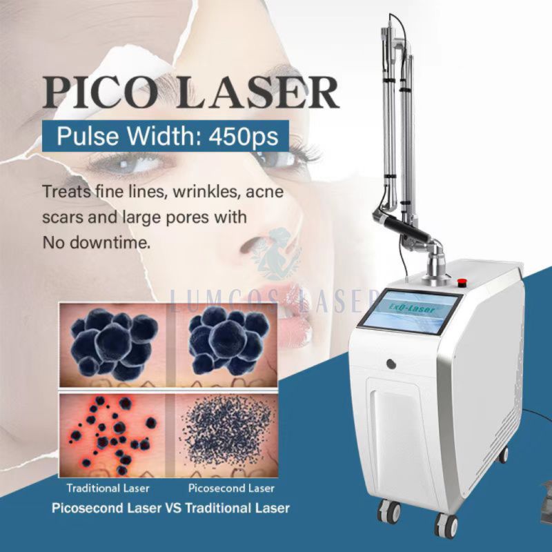 Tattoo Removal,picolaser,pico Laser Treatment