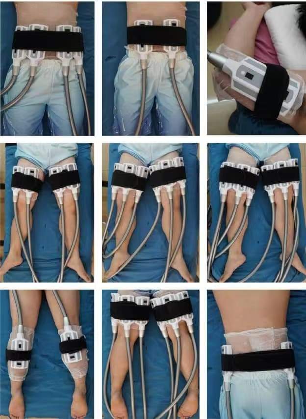 8 pads fat freezer cryopolisis