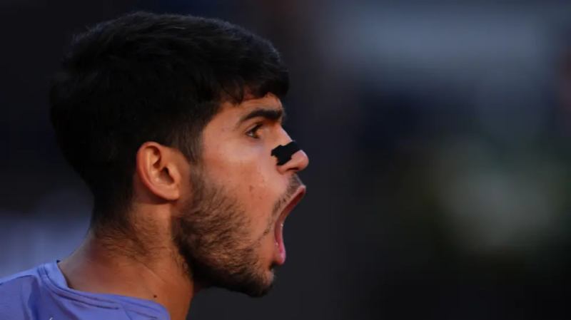 Carlos Alcaraz Defeats Jannik Sinner to Win First Italian Open Title