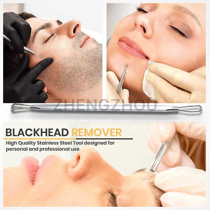 How to Use Blackhead Picking Tools Correctly