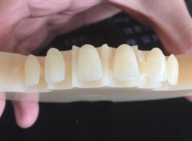 pmma material dental teeth