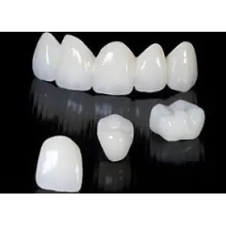 Full-contour zirconia is known for its superior strength and is best suited for patients with a heavy bite, bruxism, or even heavy canine guidance.