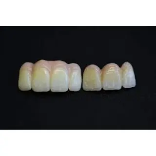 Zirconia is the most durable monolithic ceramic, which is a ceramic made without added materials.
